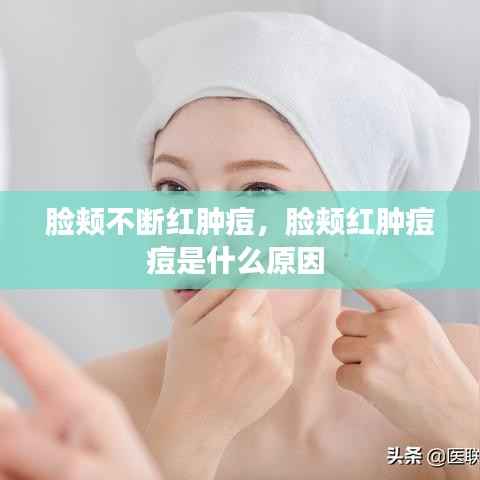 脸颊不断红肿痘，脸颊红肿痘痘是什么原因 